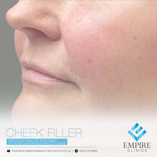 Cheek Dermal filler injections in Liverpool