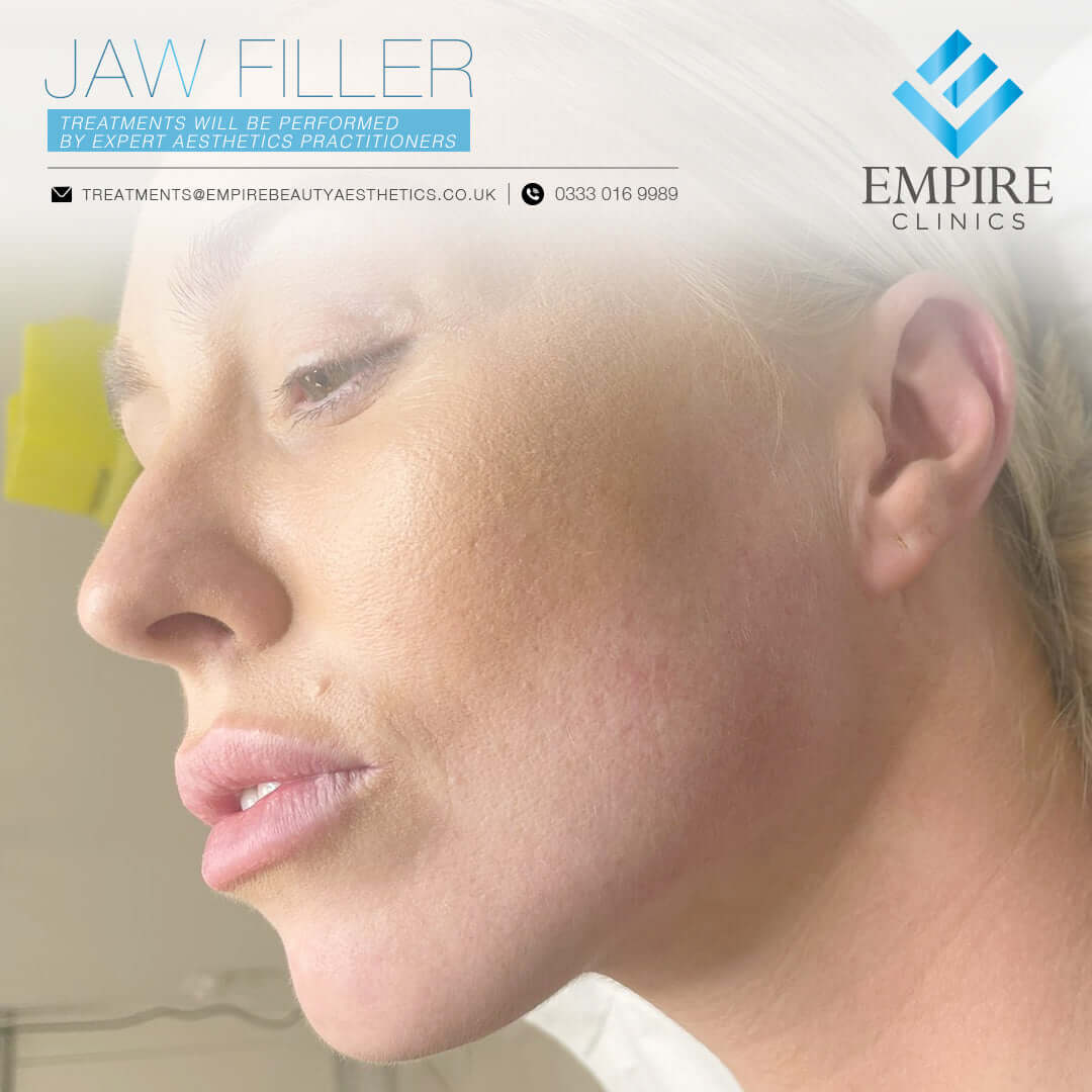 Jaw dermal filler injections in Liverpool