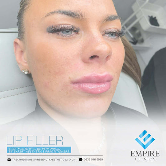 Lip dermal filler injections in Liverpool