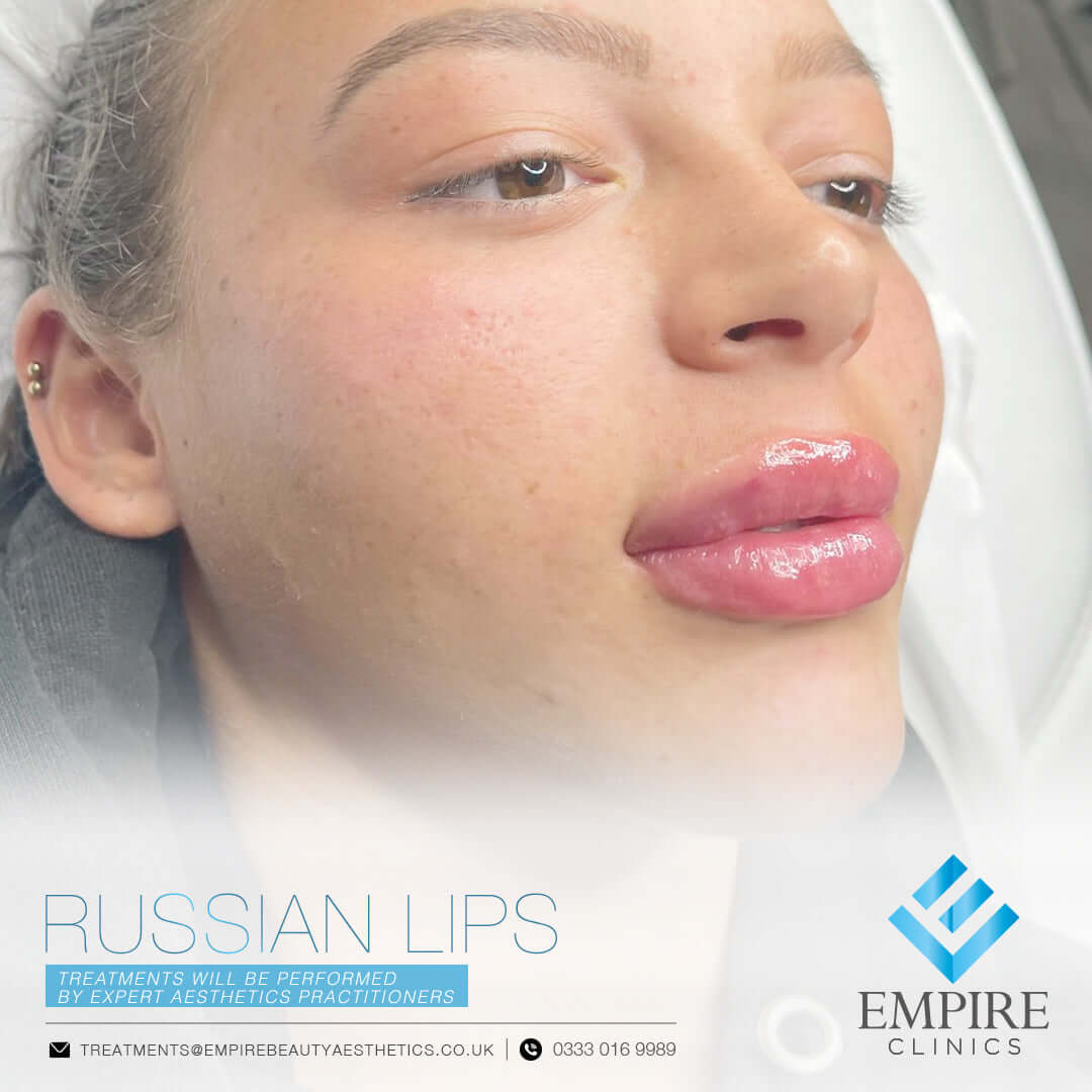 Russian lips treatment in Liverpool